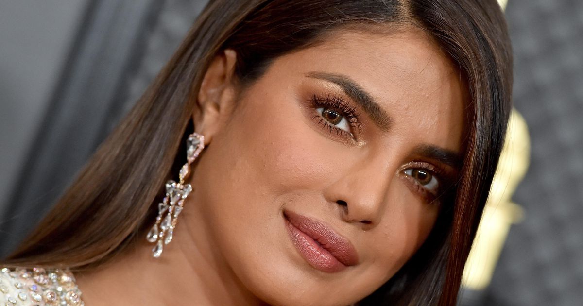 Priyanka Chopra had the polyps removed but lost the shape of her nose  entertainment