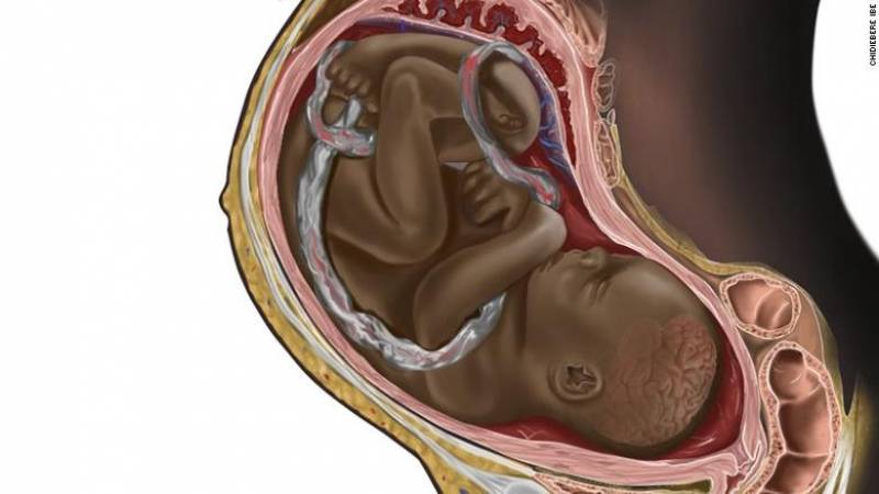 The maker of the black fetus sketch wants a better representation in the medical world