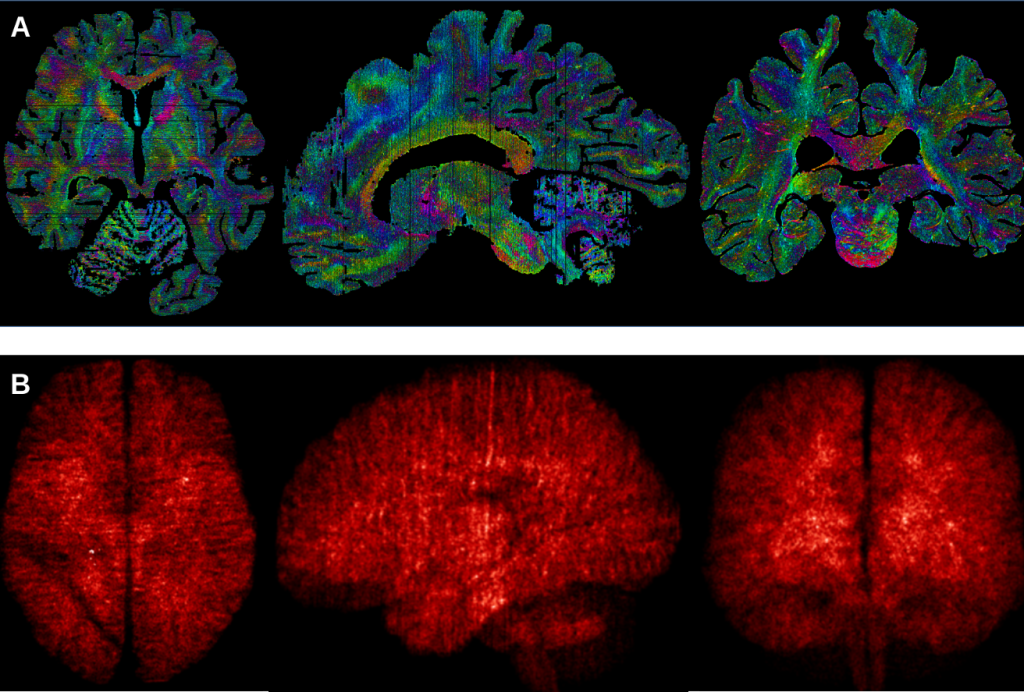 UvA scientists perform highly detailed 3D reconstruction of the human brain